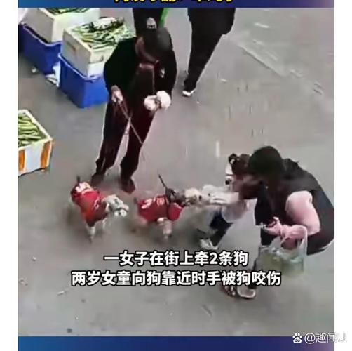 女童被狗扑咬受伤,女儿被小狗咬了没出血怎么办
