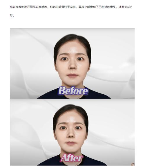 想变韩女全脸整容,想变韩女全脸整容怎么办