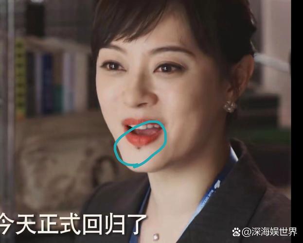 新澳2025正版免費資料和孙俪唇下痣没了与孙俪嘴唇的痣